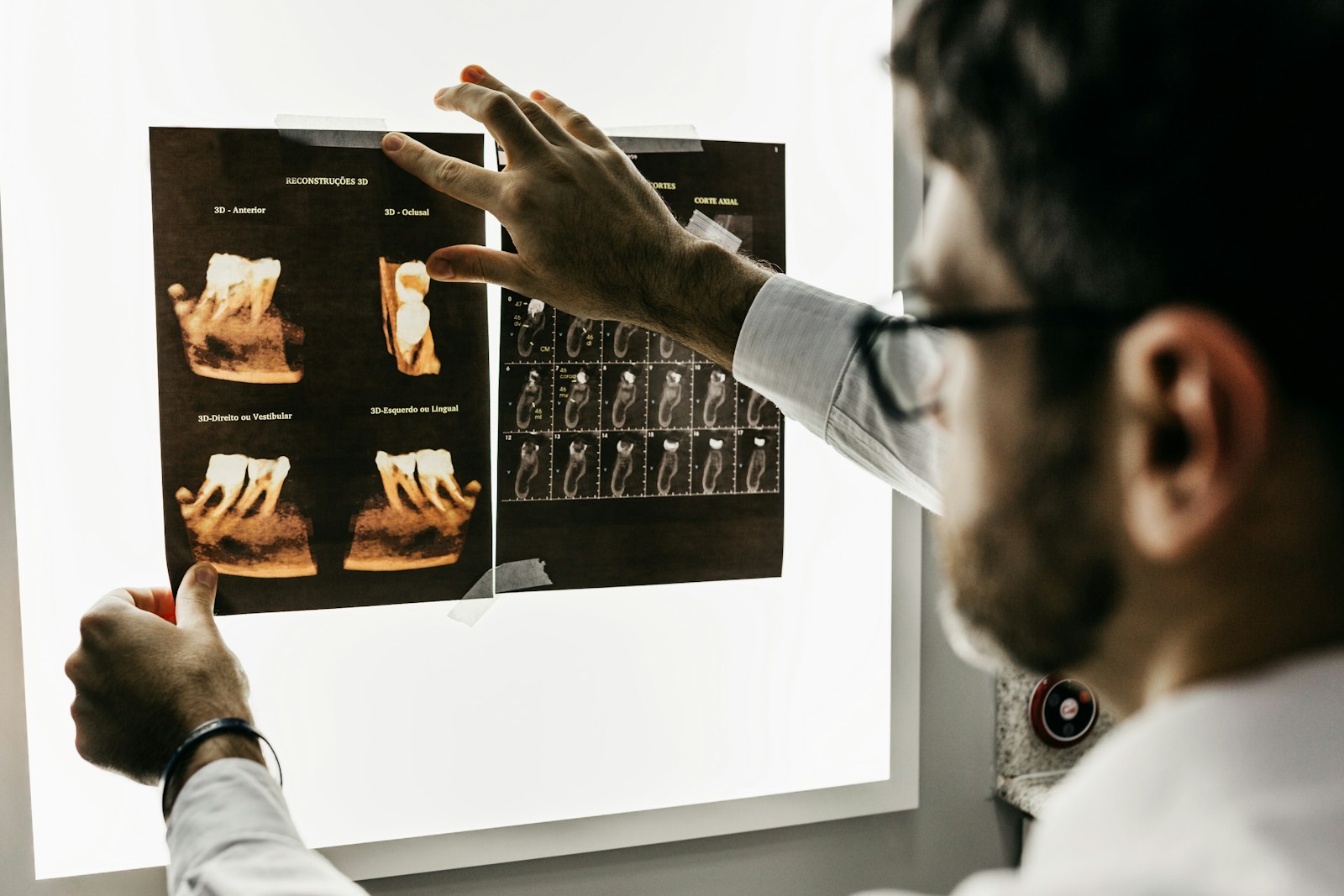 Revisión de diagnóstico dental